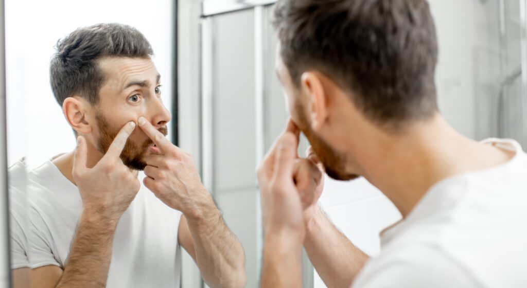 Acne primaverile: perché peggiora e come gestirla