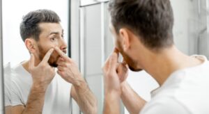Acne primaverile: perché peggiora e come gestirla